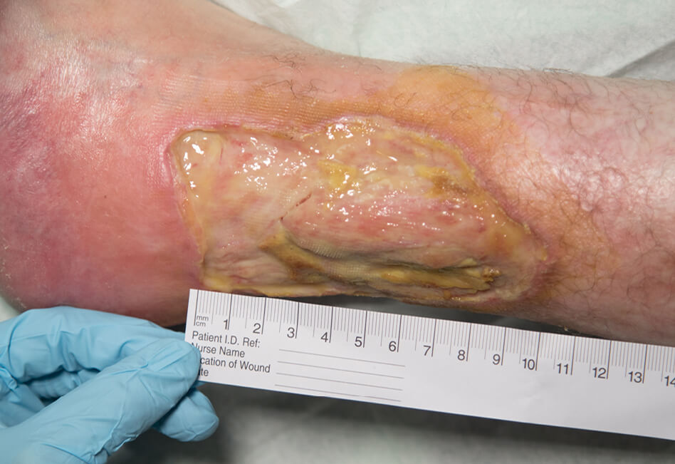 LUR-Biofilm-when@4x
